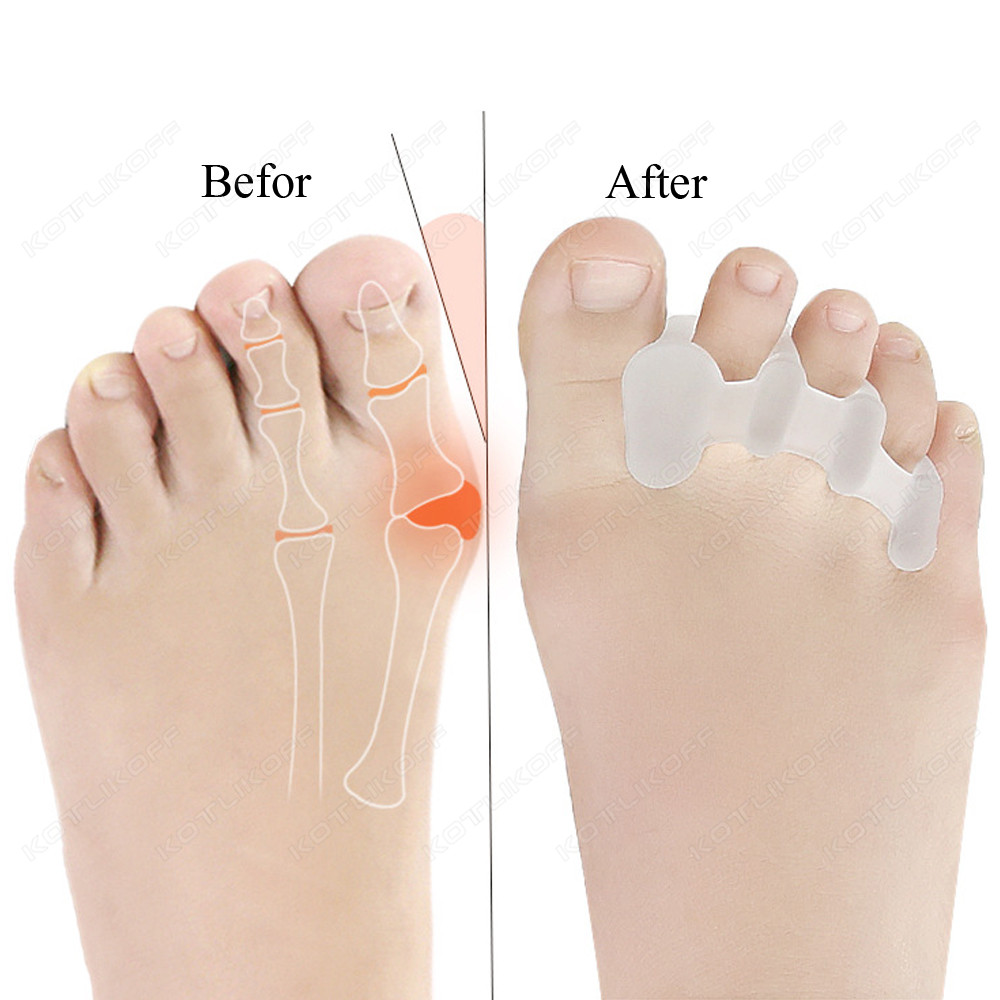 Toe Protective Toes Separator  - Shoe Polish Cream 评论和价格