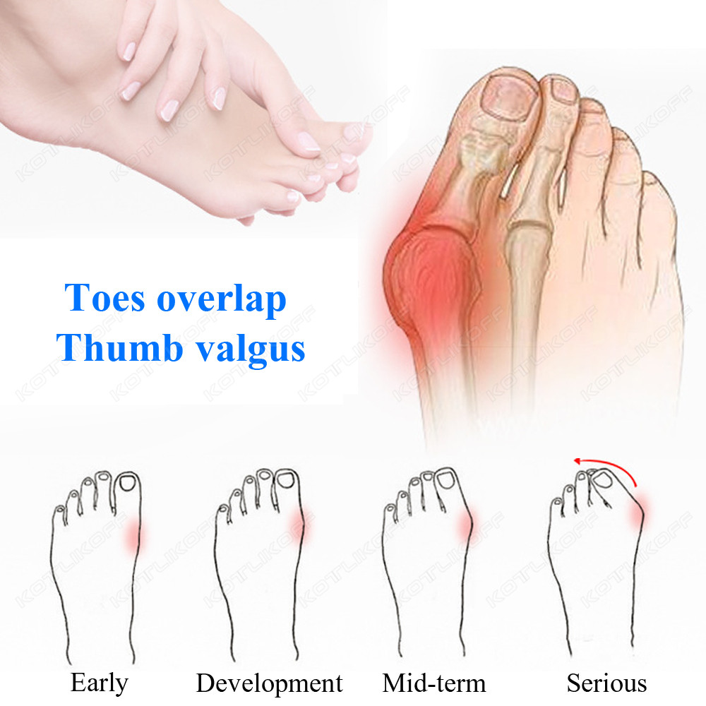 Toe Protective Toes Separator  - Shoe Polish Cream 评论和价格